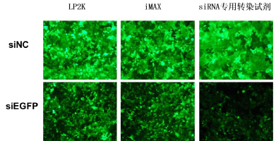 稳定表达GFP的HeLa-EGFP细胞，沉默siEGFP，48h后荧光拍照