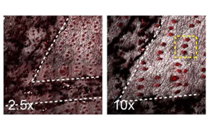 Nature新研究解释了为什么癌基因突变的细胞可以在正常的人体组织中存在