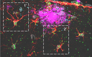 《Nature Neuroscience》可增强神经胶质细胞的蛋白质