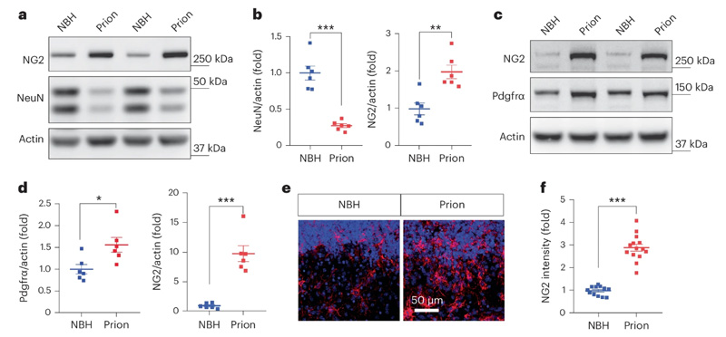 朊病毒疾病模型中NG2胶质细胞的激活